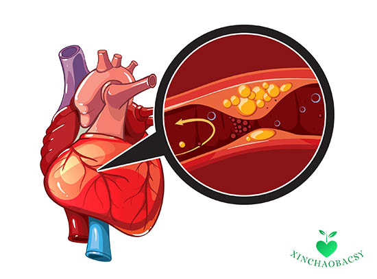 Các loại thuốc thường được chỉ định để điều trị hẹp động mạch vành